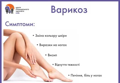 Баня и варикоз: союз невозможен - Estonian Vein Clinic