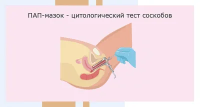 Лейкоплакия щек и губ в месте прикуса - Терапия - Стоматология для всех