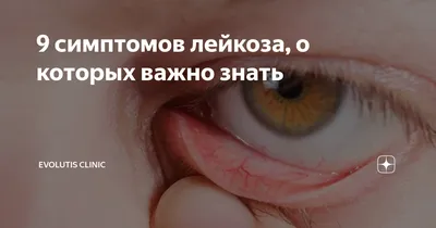 ДЕТСКИЙ ОНКОЛОГ - ГЕМАТОЛОГ on Instagram: \"Лейкоз у детей. Продолжение...  Основные симптомы на фото в карусели ▶️ Диагностика и лечение острого  лейкоза . ❗ Результаты анализов должен расшифровать только специалист!  Список необходимых