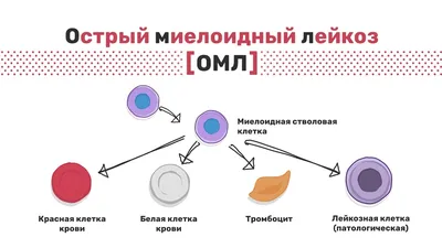 Лечение лейкоза за границей - 20 клиник ➤ Цены и отзывы о лечении лейкозе  за рубежом