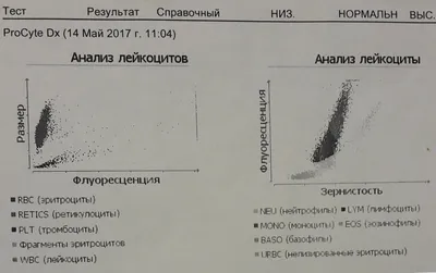 Всё о лейкозе: пути передачи вируса, симптомы, лечение