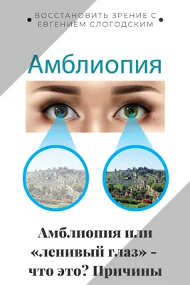 Синдром «ленивого глаза» – зачем нужны заклейки? | Статьи от клиники Сокол