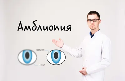 Синдром ленивого глаза - «ДВЦОЗ» — Дальневосточный центр охраны зрения