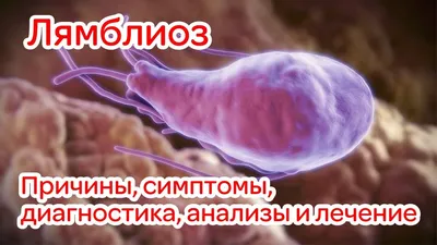 Холецистит (Cholecystitis) хронический и острый - симптомы и лечение у  женщин и мужчин, причины и диагностика заболевания, какой врач лечит,  анализы