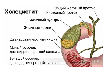 Глисты: фото, симптомы, у человека, у детей, у кошек, анализы