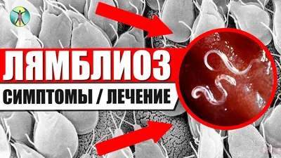 Противопротозойный препарат с антибактериальной активностью Polpharma  Трихопол метронидазол таблетки 250 мг - «Трихопол при лямблиозе. Сколько  пить и будет ли результат? Расскажу о побочках у взрослых и 8-илетнего  ребенка.» | отзывы