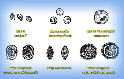 Лямблиоз и жиардиаз: симптомы, причины и лечение - полная информация