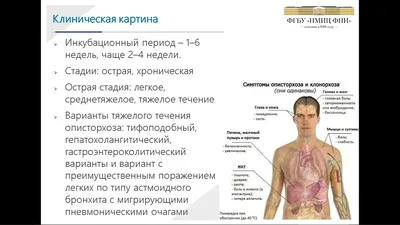 Лямблии у ребенка: симптомы и лечение лямблиоза у детей