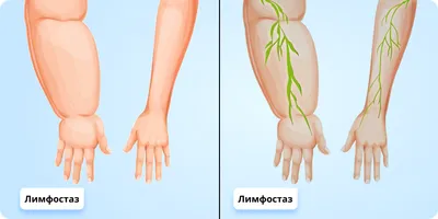 Лимфа и долголетие. Путь к укреплению иммунитета и предупреждению болезней  Джеральд Лемоль - купить книгу Лимфа и долголетие. Путь к укреплению  иммунитета и предупреждению болезней в Минске — Издательство Альпина  Паблишер на