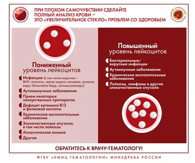 Лимфома: симптомы и признаки, стадии, прогноз, классификация, причины,  диагностика и лечение лимфом