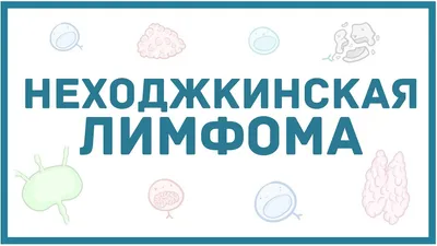 Лимфома Ходжкина | ⚕️ Злокачественное заболевание лимфатической системы,  известное как болезнь Лимфома Ходжкина, занимает 7 место в структуре  заболеваемости болезнями... | By Национальный научный онкологический центр  | Facebook