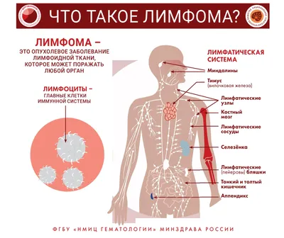 Онко Вики — Рак и лимфатические узлы