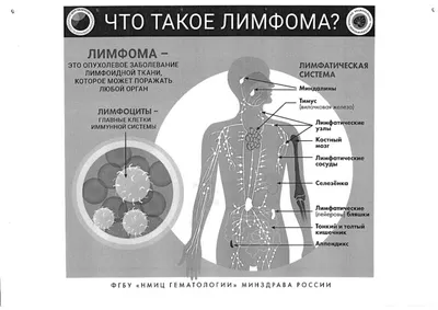 Хрипы в грудной клетке - причины появления, при каких заболеваниях  возникает, диагностика и способы лечения