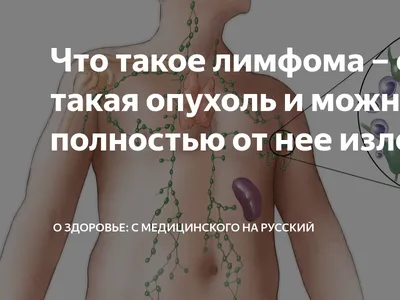 Что такое рак миндалин: стадии развития и факторы риска - Clinics on Call