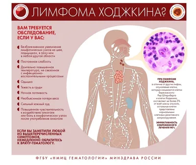 Неклассифицируемая В-клеточная лимфома, занимающая промежуточное положение  между диффузной В-крупноклеточной лимфомой и лимфомой Беркитта в детском  возрасте – тема научной статьи по клинической медицине читайте бесплатно  текст научно-исследовательской ...