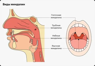 Лейкемия и лимфома: Различия и сходства