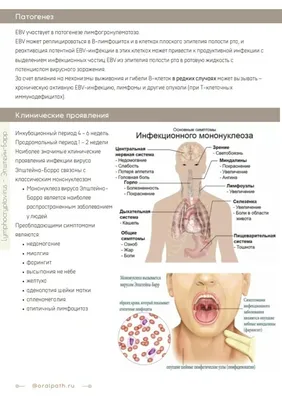 Иллюстрация 10 из 10 для Лимфомы у детей - Менткевич, Маякова, Барышников |  Лабиринт - книги. Источник: Лабиринт