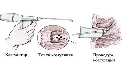 Фурункулы Лечение в Киеве | Универсум Клиник