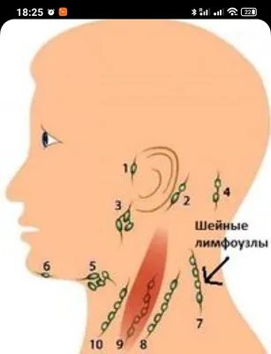 УЗИ подчелюстных лимфоузлов - сделать в Одессе | Амбулатория семейного  доктора