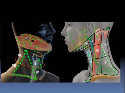 Лимфоузлы шеи. + | Портал радиологов