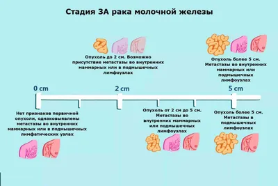 Рак кожи: симптомы, фото, диагностика и лечение