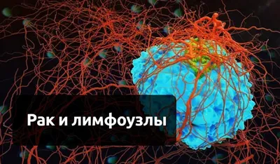 История изучения внутригрудных лимфоузлов при раке легкого — Практическая  медицина — Практическая медицина. Журнал для практикующих врачей и  специалистов