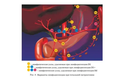 Компьютерная томография лимфатических узлов с контрастом в Краснодаре —  УРО-ПРО