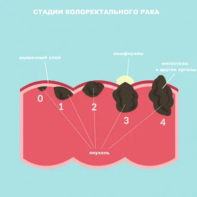 Что такое лимфатические узлы и что делать, если они увеличились?