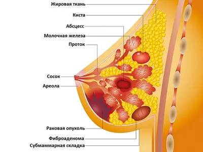 Рак молочной железы — ГАУЗ БОКД