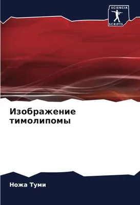 ПЕРВИЧНАЯ ДЕДИФФЕРЕНЦИРОВАННАЯ ЛИПОСАРКОМА ПЕЧЕНИ: ПЕРВОЕ В РУСCКОЯЗ