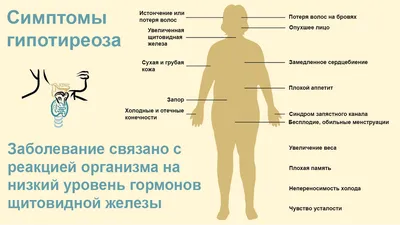 Тиреотоксикоз и гипотиреоз: как распознать отклонения в работе щитовидной  железы