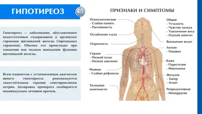 Тиреотоксикоз и гипотиреоз: как распознать отклонения в работе щитовидной  железы