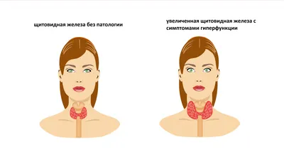 Консервативное лечение заболеваний щитовидной железы - online presentation