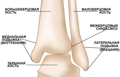 Все о переломе лодыжки