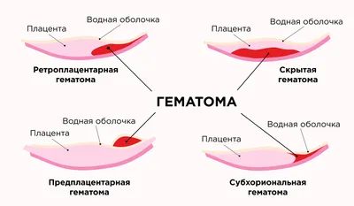 Ольга Суворова - ЛОХИИ НОРМА И ПАТАЛОГИЯ ⠀ Девочки, начнём... | Facebook