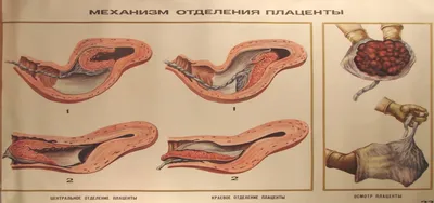 Сокращение матки после родов