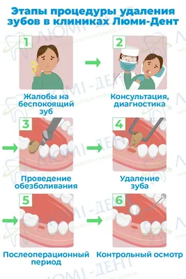 Заживление лунки после удаления зуба - этапы, симптомы и возможные  осложнения, рекомендации