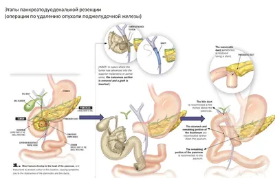 Blog | Кокцигодиния (анокопчиковый болевой синдром)