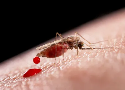 Малярия: лечение, симптомы, диагностика, классификация