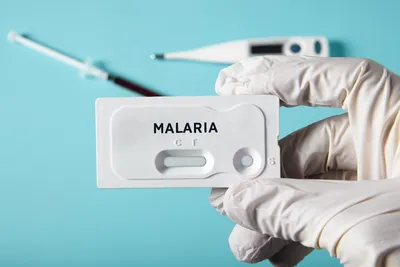 Малярия - УЗ «МОГИЛЕВСКИЙ ОБЛАСТНОЙ ЛЕЧЕБНО-ДИАГНОСТИЧЕСКИЙ ЦЕНТР»