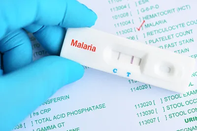 Профилактика малярии - Государственное учреждение здравоохранения \"Детская  областная больница\"