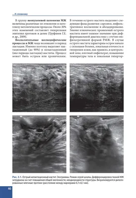 Узи картина мастита - 80 фото