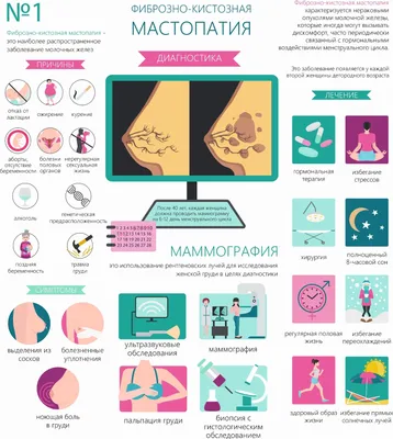 Мастопатия молочных желез - фиброзно-кистозная болезнь, её симптомы,  признаки, лечение