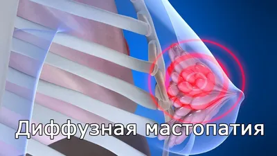 Купить Лекарства от мастопатии в ближайшей аптеке Планета Здоровья