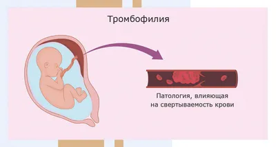 Медикаментозный аборт в СПб: ответы гинекологов на вопросы