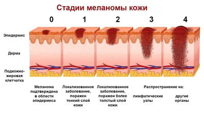 Меланова-это серьезно