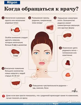 Меланома кожи: как выглядит, симптомы, причины, диагностика, лечение