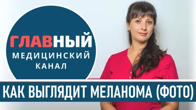 Ю.С.Васильев - Меланома кожи