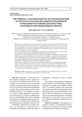 Прием у врача: что представляет собой диагностика меланомы кожи?