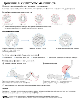Менингит: причины, симптомы, признаки, классификация, диагностика, лечение